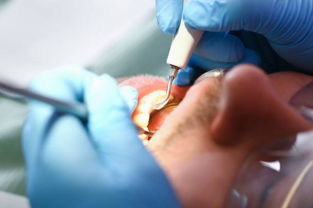 Best Emergency Gum Pain Relief  in Hapeville, GA