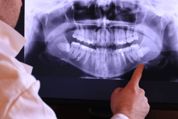 Best Root Canal Emergency Dentist  in Hapeville, GA